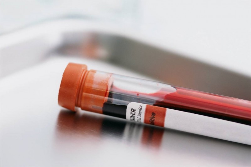 Titer Testing For Dogs