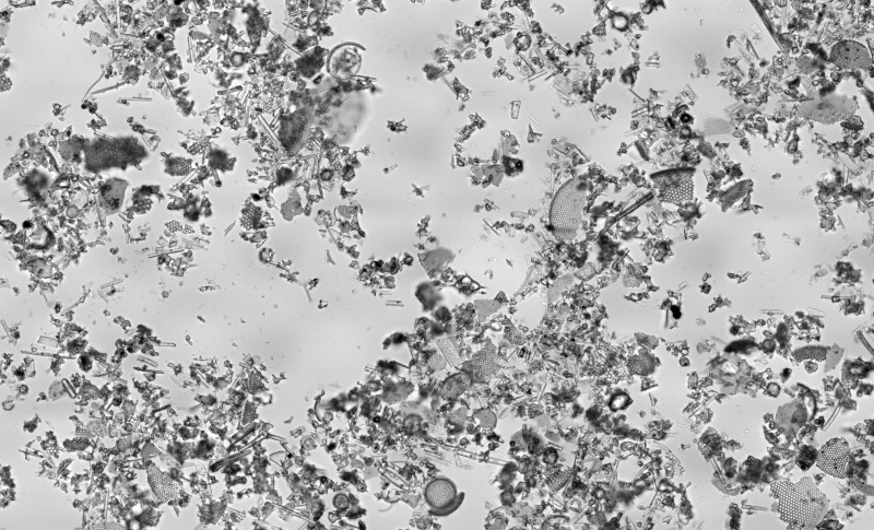 Magnified Diatomaceous Earth Natural Insect Control