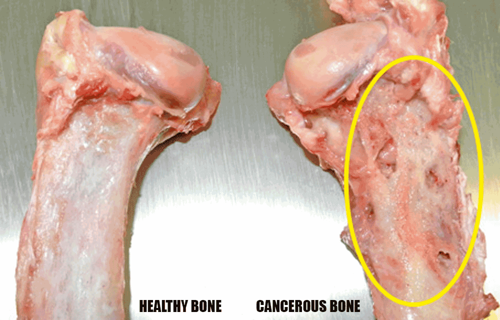 bone cancer (osteosarcoma) in greyhounds